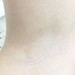 ミュゼって 効果ある?7回目の効果と経過をアップします