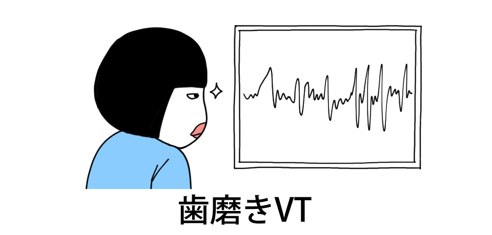 歯磨きVT